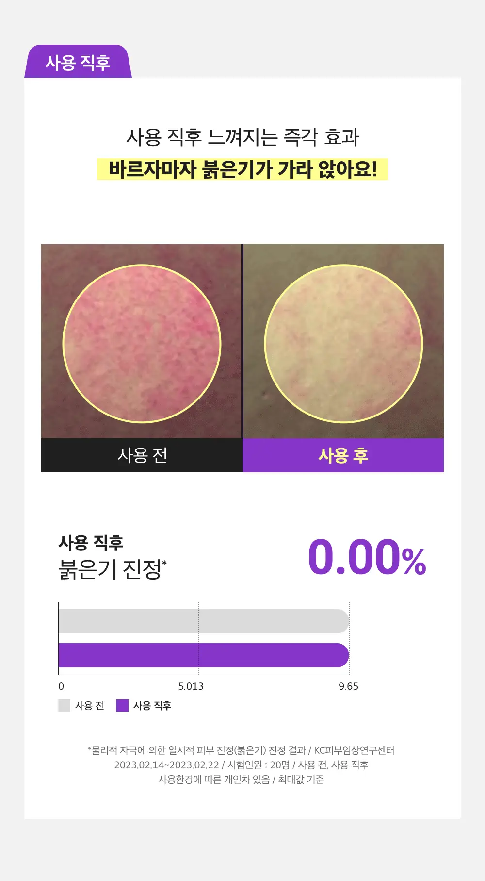 [잡티미백케어] 성분에디터 머루포도 비타씨 다크 스팟 앰플 40ml 더블기획 상세페이지 17